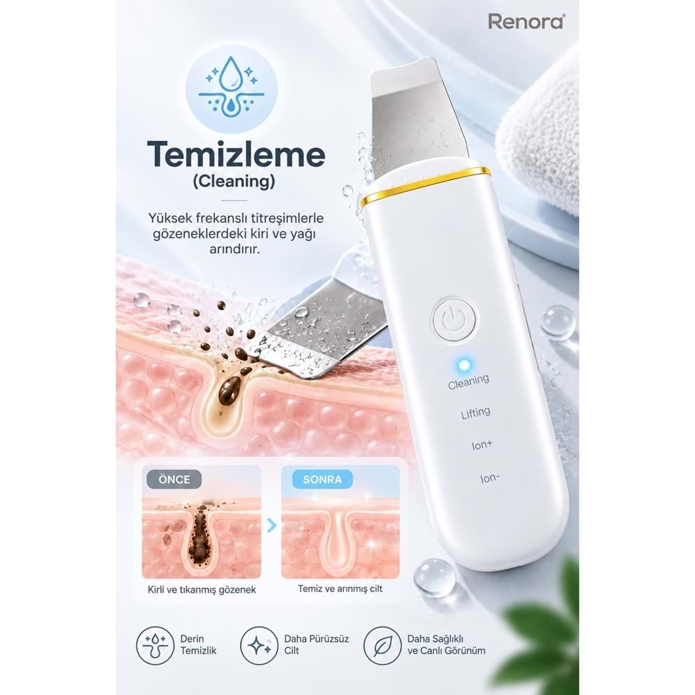 CONCORD SM-15 RENORA 4IN1 Ultrasonic Cilt Temizleme Spatulası