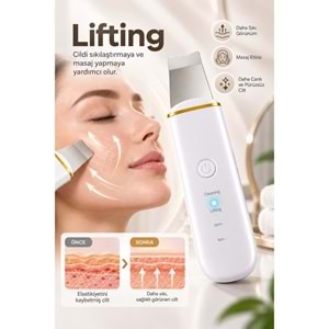 CONCORD SM-15 RENORA 4IN1 Ultrasonic Cilt Temizleme Spatulası