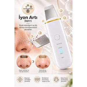 CONCORD SM-15 RENORA 4IN1 Ultrasonic Cilt Temizleme Spatulası