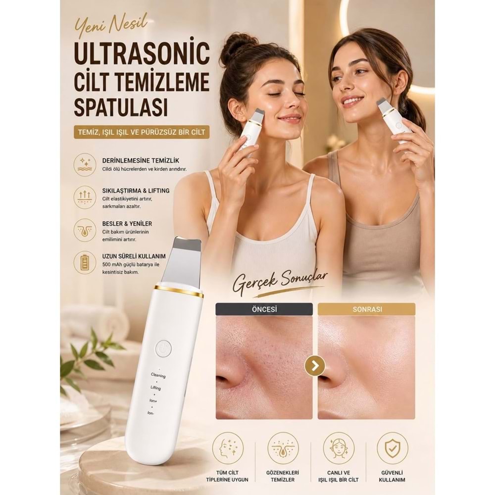 CONCORD SM-15 RENORA 4IN1 Ultrasonic Cilt Temizleme Spatulası